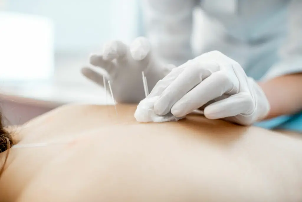 acupuncture wandsworth